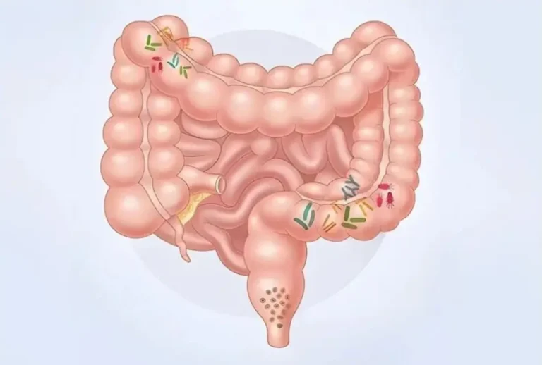 腸道健康療法